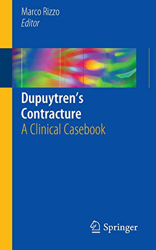 【预订】Dupuytren S Contracture: A Clinical ...