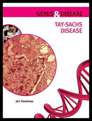 【预售】Tay-Sachs Disease