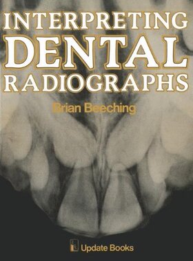 【预订】Interpreting Dental Radiographs