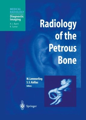 【预订】Radiology of the Petrous Bone