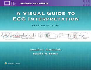 Visual 预订 Interpretation ECG Guide