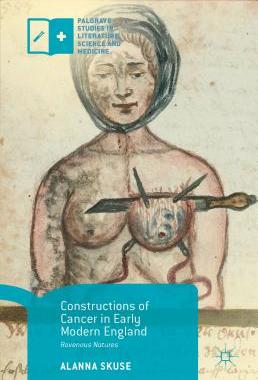 【预售】Constructions of Cancer in Early Mod...