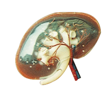 透明肾脏放大模型A14008