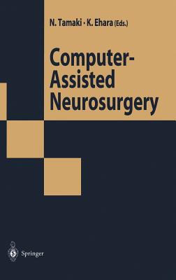 【预订】Computer-Assisted Neurosurgery