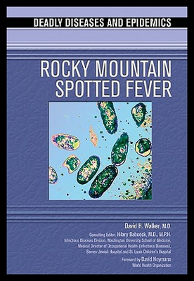 【预售】Rocky Mountain Spotted Fever