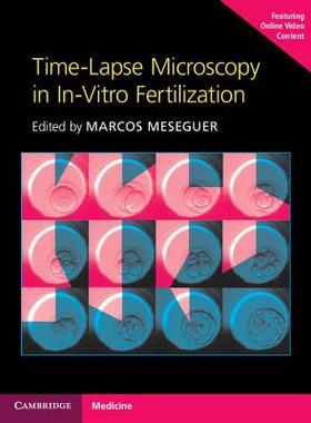 【预订】Time-Lapse Microscopy in In-Vitro Fe...