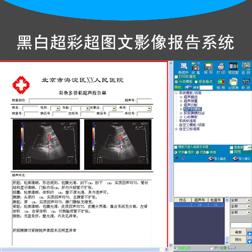 彩超黑白超病历图文影像报告系统B超软件视频采集卡脚踏板连接线