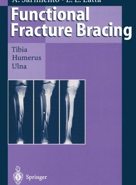【预订】Functional Fracture Bracing: Tibia, ...
