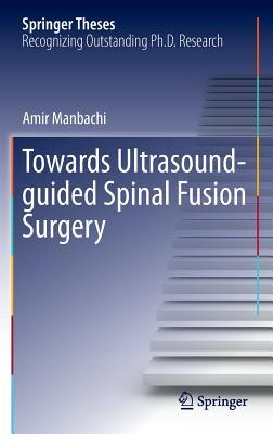 【预订】Towards Ultrasound-guided Spinal Fus...