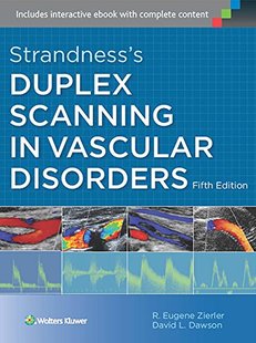 Scanning Disorders Duplex Strandness Vascular 预售