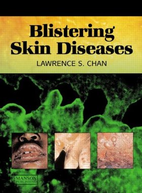 【预售】Blistering Skin Diseases