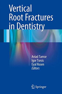 【预订】Vertical Root Fractures in Dentistry