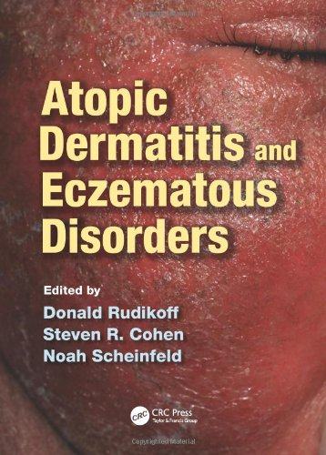 美国库房发货，通常付款后5-8周到货！