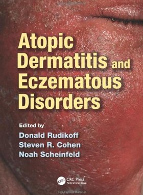 【预售】Atopic Dermatitis and Eczematous Disorders