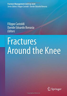 【预订】Fractures Around the Knee