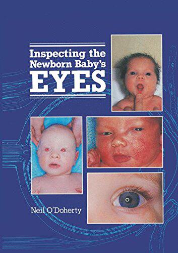 【预订】Inspecting the Newborn Baby's Eyes
