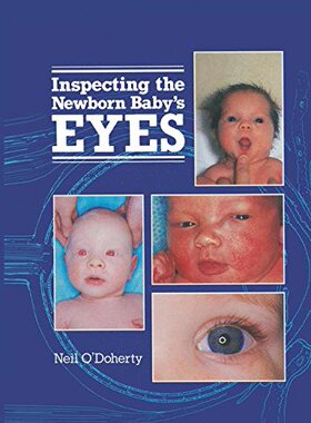 【预订】Inspecting the Newborn Baby's Eyes