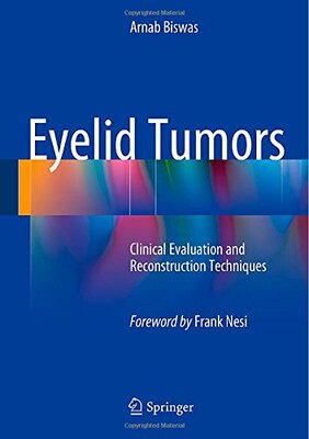 【预订】Eyelid Tumors