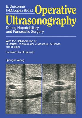 【预订】Operative Ultrasonography: During He... 书籍/杂志/报纸 原版其它 原图主图