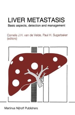 【预订】Liver Metastasis: Basic Aspects, Det...