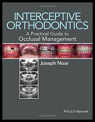 【预售】Interceptive Orthodontics: A Guide to the Develop