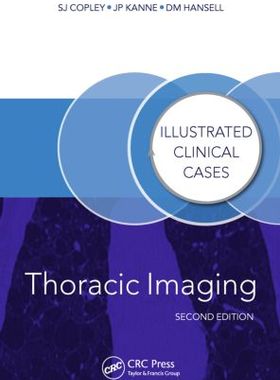 【预售】Thoracic Imaging, Second Edition