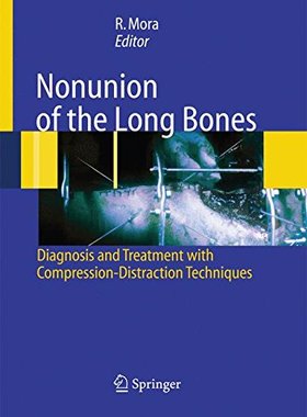 【预订】Nonunion of the Long Bones: Diagnosi...
