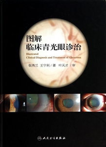 图解临床青光眼诊治(精)  博库网
