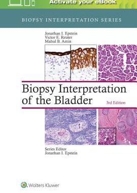 【预订】Biopsy Interpretation of the Bladder