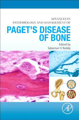 【预订】Advances in Pathobiology and Managem...