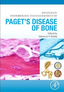 【预订】Advances in Pathobiology and Managem...