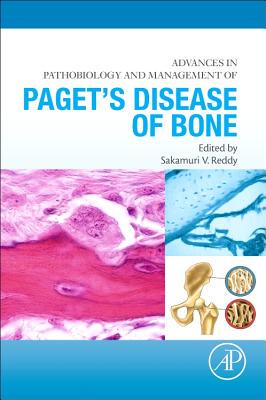【预订】Advances in Pathobiology and Managem...