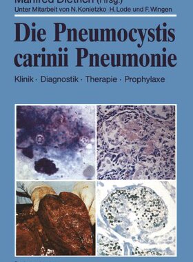 【预订】Die Pneumocystis Carinii Pneumonie: ...