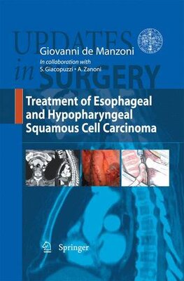 【预订】Treatment of Esophageal and Hypophar...
