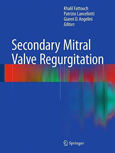 【预售】secondary mitral valve regurgitation