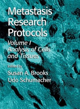 【预订】Metastasis Research Protocols
