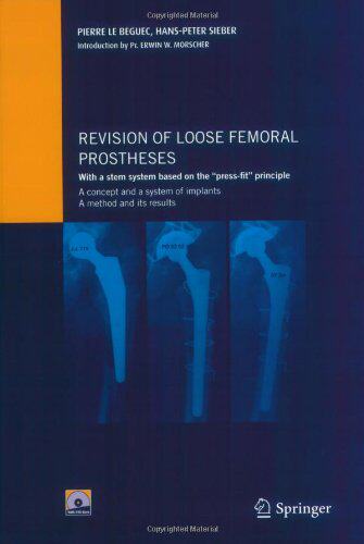 【预售】Revision of loose femoral prostheses with a st...