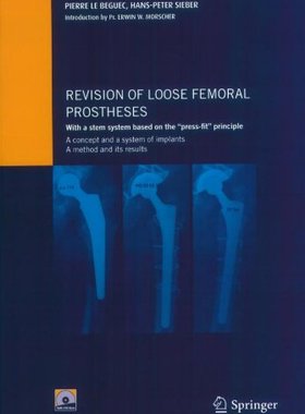 【预售】Revision of loose femoral prostheses with a st...