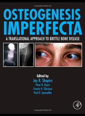 【预售】Osteogenesis Imperfecta: A Translational Approach