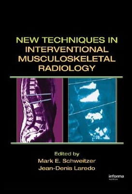 【预售】New Techniques in Interventional Muscu