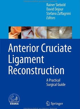 【预订】Anterior Cruciate Ligament Reconstruction