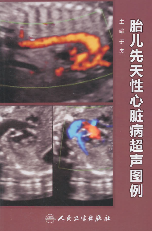 胎儿先天性心脏病超声图例 人民卫生出版社 于岚