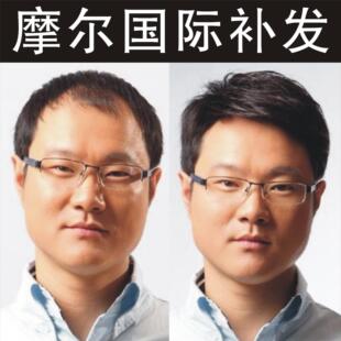 订做摩尔补发织发男士 德国密亚麻丝网底自由梳理100%真人发丝发片