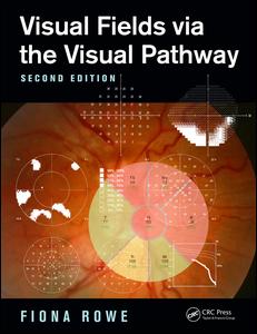 【预订】Visual Fields via the Visual Pathway...