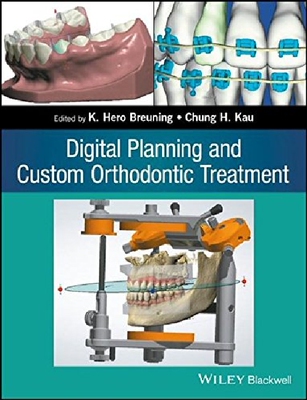 【预订】Digital Planning and Custom Orthodon...