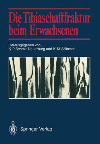 【预订】Die Tibiaschaftfraktur Beim Erwachse...