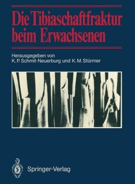 【预订】Die Tibiaschaftfraktur Beim Erwachse...
