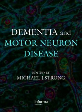 【预售】Dementia and Motor Neuron Disease