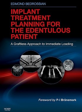【预售】Implant Treatment Planning for the Edentulous P