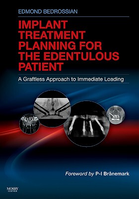 【预售】Implant Treatment Planning for the Edentulous P